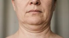 5 övningar som hjälper dig att bli av med dubbelhakan